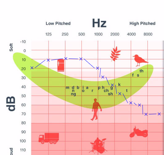 Tone audiogram with frequency annotation